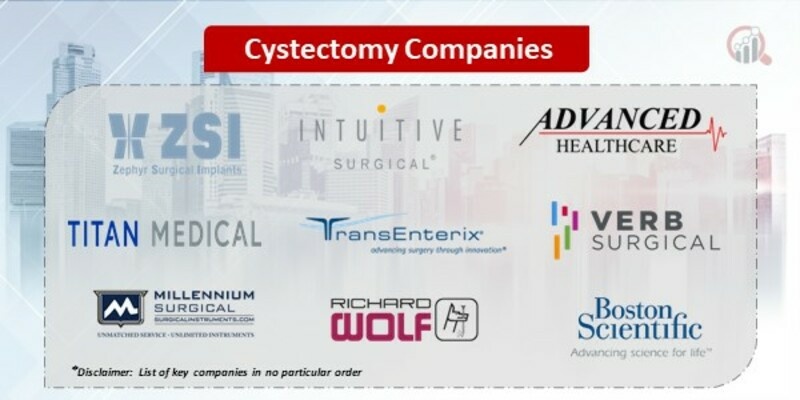 Cystectomy Companies