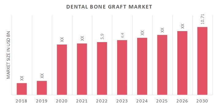 Dental Bone Graft Market Overview