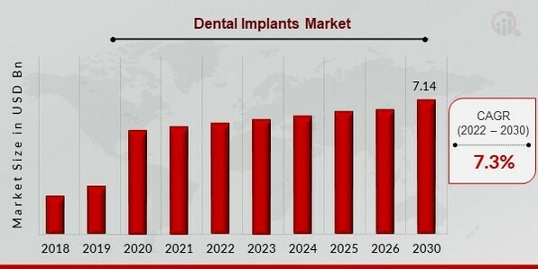Dental Implants Market Overview