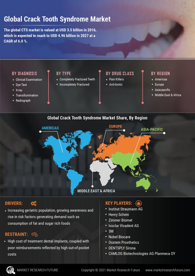 Crack tooth syndrome Market