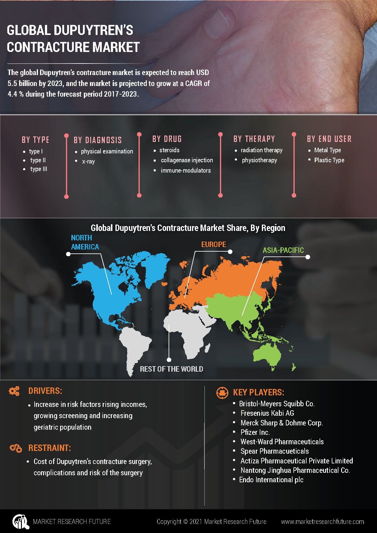 Dupuytren’s Contracture Market