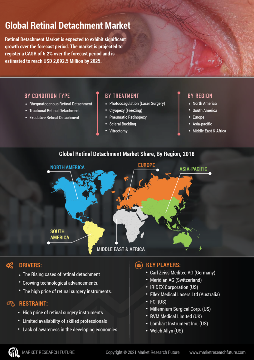 Retinal Detachment treatment Market