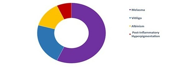 Hyperpigmentation Disorders Treatment Market around the globe