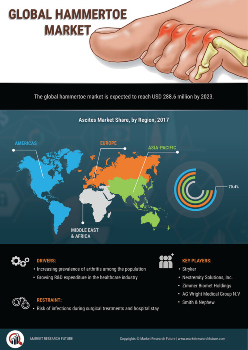 Hammertoe Market