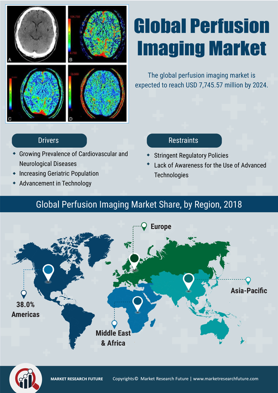 Perfusion Imaging Market