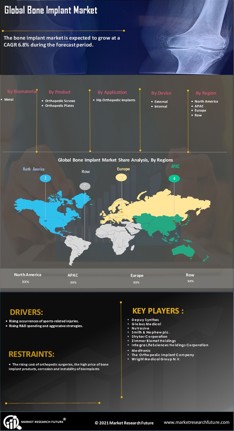 Bone Implant Market