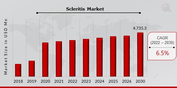 Scleritis Key Companies