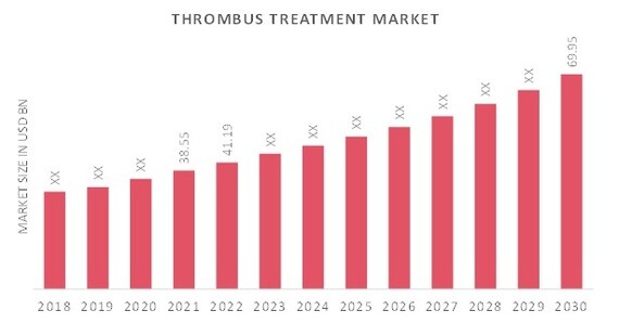 Thrombus Treatment Market Overview