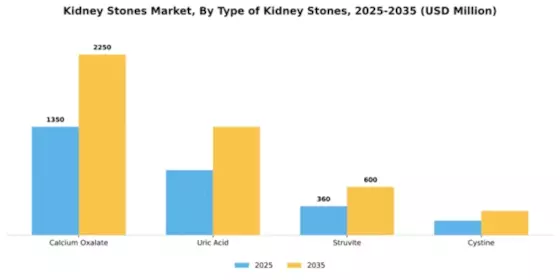 Kidney Stones Market Segment Image 3