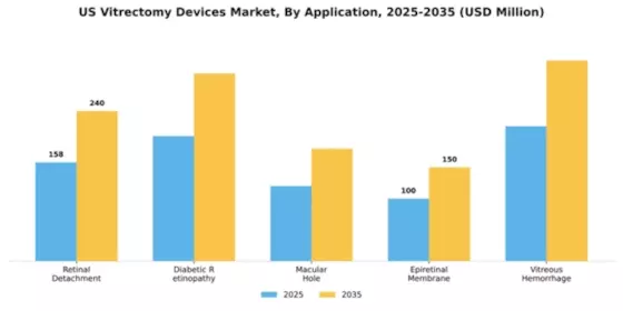 US Vitrectomy Devices Market Segment Image 0