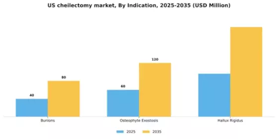 US Cheilectomy Market Segment Image 1