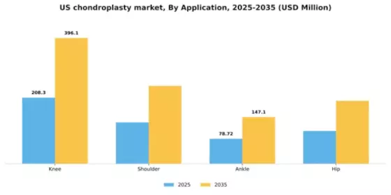 US Chondroplasty Market Segment Image 0
