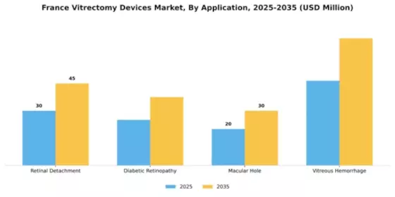 France Vitrectomy Devices Market Segment Image 0