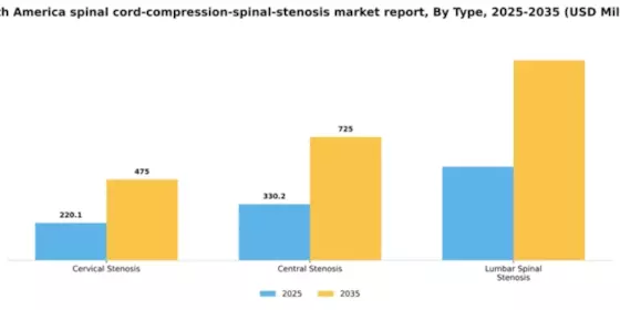 South America Spinal Cord Compression Spinal Stenosis Market Segment Image 3