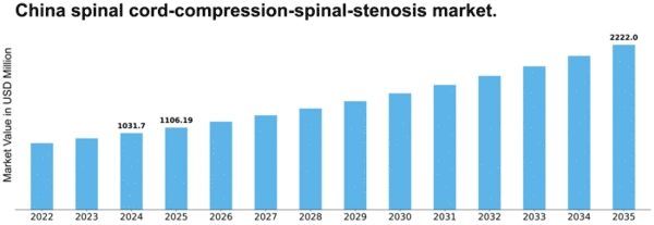 China Spinal Cord Compression Spinal Stenosis Market Size