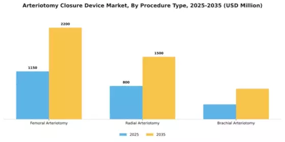 Arteriotomy Closure Device Market Segment Image 3